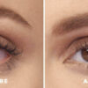 Gouttes Lumify Avant Après
